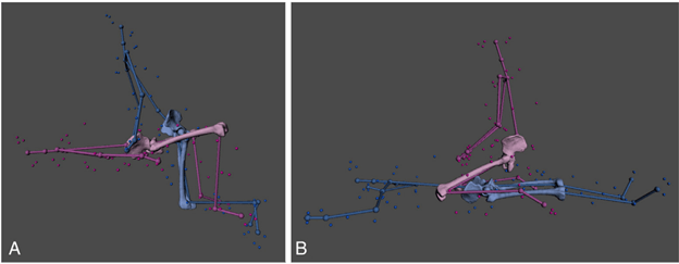 Кинематическое исследование движений в тазобедренном суставе